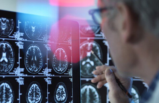 فقدان العضلات مع التقدم في العمر قد يرتبط بارتفاع خطر الخرف.. ماذا كشفت دراسة جديدة؟