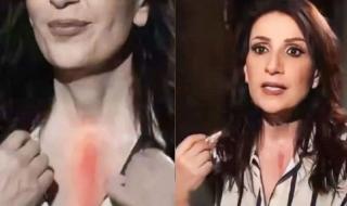 شاهد .. بالفيديو- وفاء موصللي تتحدث لأول مرة عن خضوعها لـ عملية خطيرة وتكشف عن جرحها الكبير