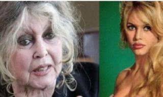 شاهد .. تطورات الحالة الصحية للممثلة الفرنسية بريجيت باردو بعد إصابتها بمرض خطير